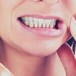 Bolest Zubů Při Skousnutí: Príčiny, Léčba & Prevence! 9 a person holding their cheek while smiling to show tooth sensitivity or pain during biting, highlighting exposed gum area.
