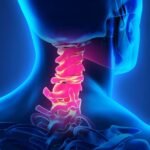 a 3D medical illustration highlighting the cervical spine with inflammation, indicating potential causes like poor posture or stress-related tension.