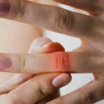 a person applying a natural cream or balm to relieve joint pain on their hand, focusing on finger and knuckle area.