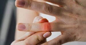 11 Domácích Metod Jak Se Zbavit Bolesti Kloubů Na Rukou!