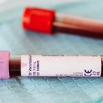 a blood collection tube with pink cap labeled "BD Vacutainer K2E 3.6mg" containing sample, relevant for genetic testing like ABO/Rh systém výpočet