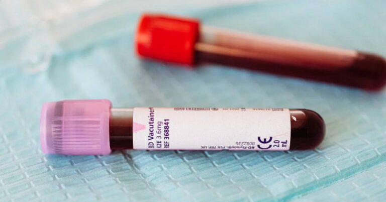 Dědičnost Krevních Skupin: Tabulka & Kalkulačka Pro Výpočet Krevní Skupiny Dítěte 9 a blood collection tube with pink cap labeled "BD Vacutainer K2E 3.6mg" containing sample, relevant for genetic testing like ABO/Rh systém výpočet