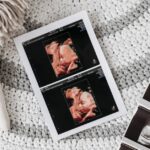 100% Přesná Kalkulačka Pro Výpočet Týdne Těhotenství 9 ultrasound images showing fetal development alongside a doll, illustrating different stages of gestational age for a pregnancy week calculator comparison