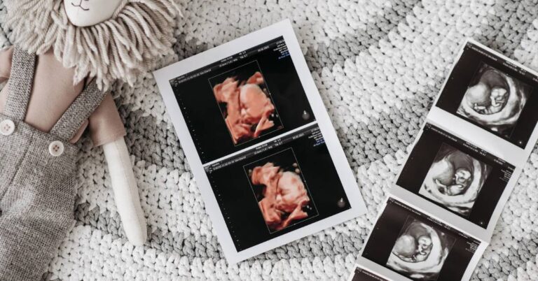 100% Přesná Kalkulačka Pro Výpočet Týdne Těhotenství 6 ultrasound images showing fetal development alongside a doll, illustrating different stages of gestational age for a pregnancy week calculator comparison