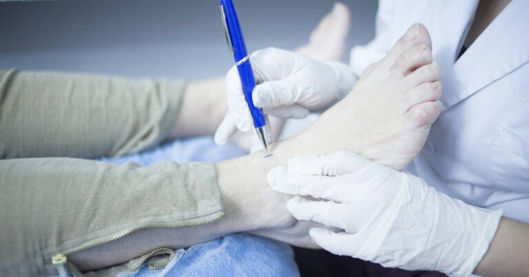 a medical professional examining a patient’s foot for potential issues like záněty šlach or artróza using a pen for palpation