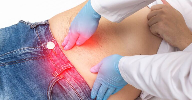 a person receiving medical examination of an inflamed, reddened navel area with noticeable irritation and swelling