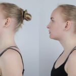 Jak odstranit hrb na krku: 5 účinných cviků jak se zbavit hrbu na krku 8 Jak odstranit hrb na krku: 5 účinných cviků pro zlepšení držení těla