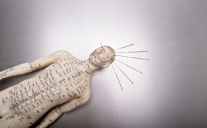 a detailed anatomical model showing acupuncture points along traditional Chinese medicine meridians on the human back and head with inserted needles for odblokování energetických toků