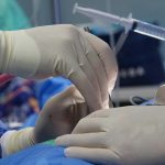 Jak na odstranění povislé kůže? Přehled všech možností, které máte k dispozici 6 Jak na odstranění povislé kůže? Přehled všech možností, které máte k dispozici