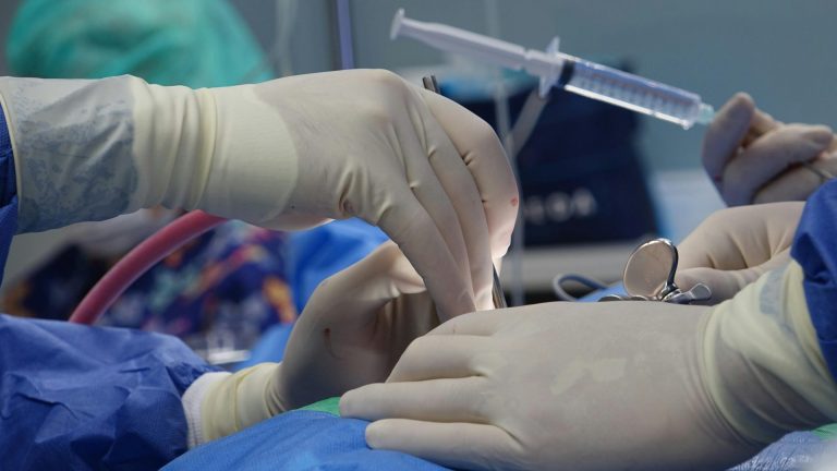 Jak na odstranění povislé kůže? Přehled všech možností, které máte k dispozici 2 medical professionals performing precise surgical procedure on facial skin, likely related to body contouring or skin tightening techniques